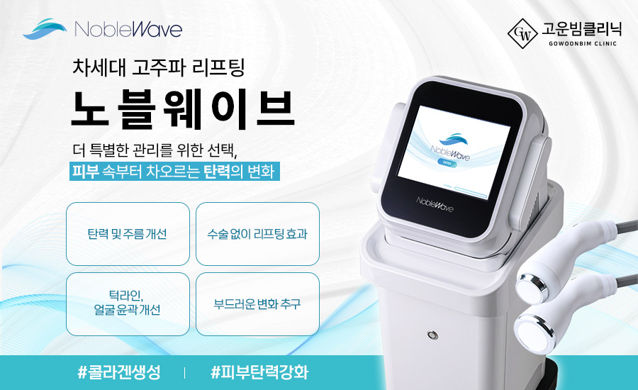 노블웨이브 도입